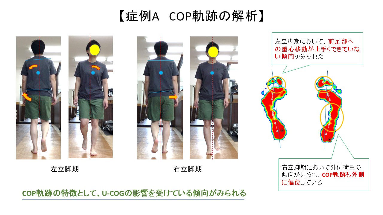 スリッパとオリジナルルームシューズの差を比較検証 歩行と姿勢の分析を活用した治療家のための専門サイト 医療従事者運営